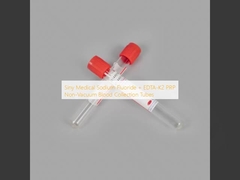Siny Medical Sodium Fluoride + EDTA-K2 PRP Non-Vacuum Blood Collection Tubes
