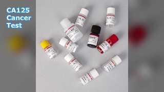 CA125 ELISA Test for Cancer Monitoring