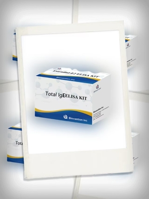 Total IgE Antibody ELISA Test Kit Serum / Plasma In Vitro Diagnostic