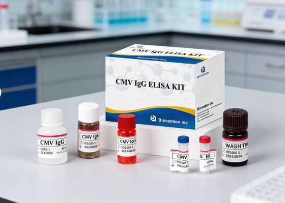 Laboratory Or Hospital High Accuracy CMV IgG Elisa Test Kit