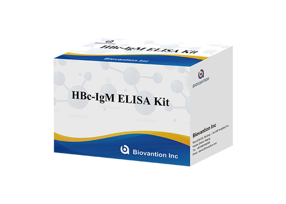 ISO13485 HBc IgM Test Kit Hepatitis B Core Antibody Igm Test