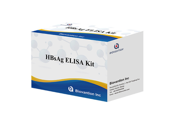 Infectious Disease HBsAg Elisa Kit Hepatitis B Surface Antigen Elisa Test