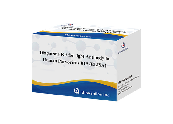 Antibody To Human Parvovirus B19 IgM ELISA Test Kit Diagnostic Kit