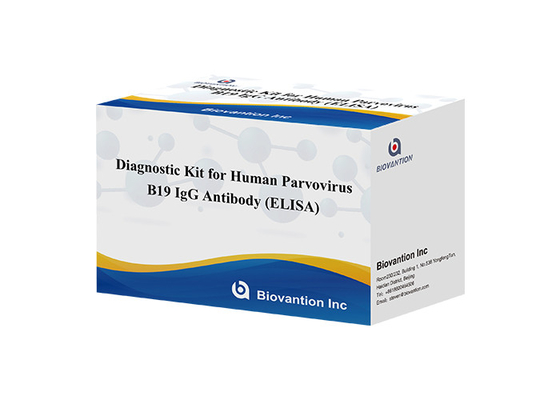 Diagnostic Kit For Human Parvovirus B19 IgG elisa test kit Antibody For Serum Samples