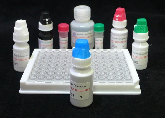 Human Anti HIV 1&2 Elisa Test Kit For Human Immunodeficiency Virus