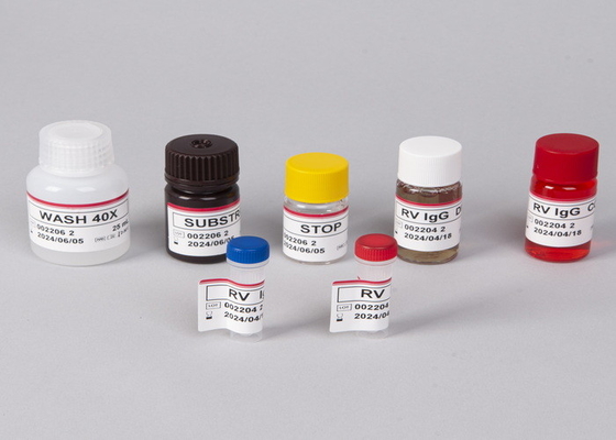 Human Immunodeficiency Virus (HIV) Antibody /Antigen ELISA Test Kit