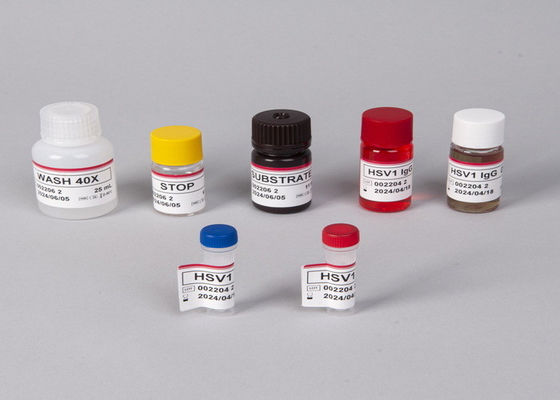 Human Immunodeficiency Virus (HIV) Antibody /Antigen ELISA Test Kit