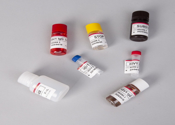 For Laboratory Or Hospital High Accuracy  CA15-3 Elisa Test Kit