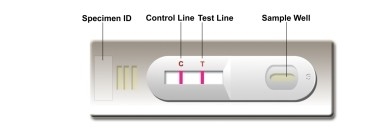 Laboratory or Hospital Self-Test High Accuracy Leishmania Ab Combo Rapid Test