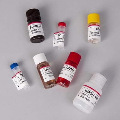 RV-G Elisa Test Kit For Plasma Sample Type Diagnosis