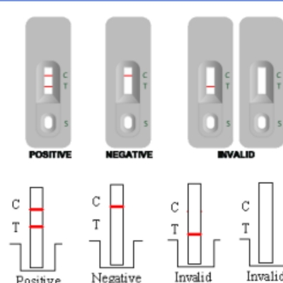 High Accuracy Professional Group A Streptococcal Antigen Rapid Test Kit with CE