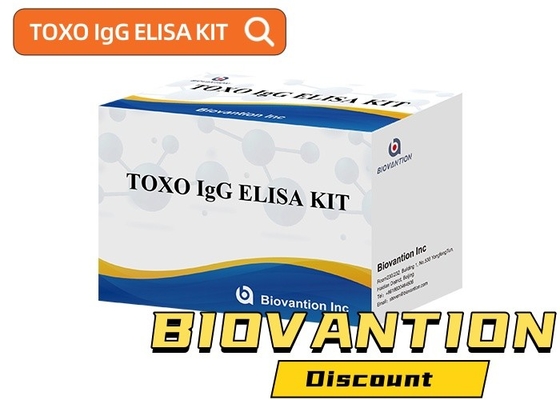 TOXO Ig G Sensitive and Specific Elisa Test Kit for Disease Monitoring