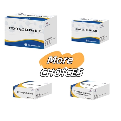 TOXO Ig G Sensitive and Specific Elisa Test Kit for Disease Monitoring
