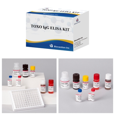 TOXO Ig G Sensitive and Specific Elisa Test Kit for Disease Monitoring