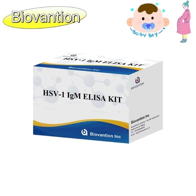 Torch ELISA Test Kit HSV 1 IgM High Hot Sale Diagnostic Reagent IVD