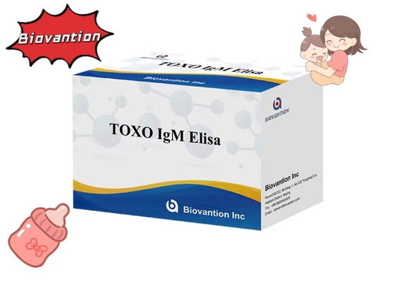 TOXO IgM ELISA Test Kit Torch High Sensitivity Hospital Test Pregnancy Check