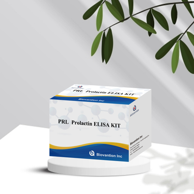 PRL Quantitative Human Hormones Diagnostic Detect Reagent Kit