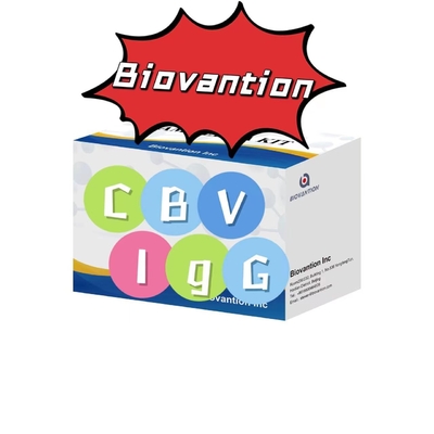 Diagnostic Kit For CBV-IgG Antibody ELISA test kit Serum Test KiT