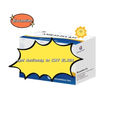 Diagnostic Kit For IgM Antibody To CBV Elisa Test Kit 50μL Serum Medical Diagnosis