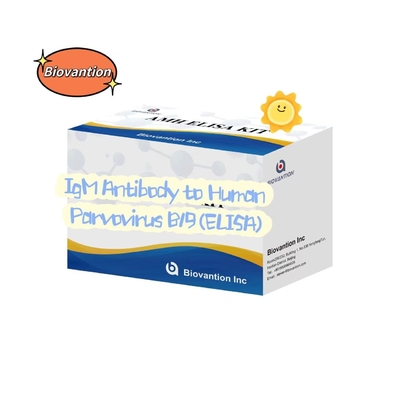 Antibody To Human Parvovirus B19 IgM ELISA Test Kit Diagnostic Kit