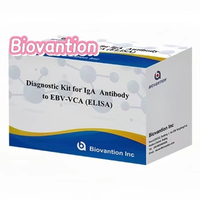 High Sensitivity EBV VCA IgA ELISA Kit for Medical Diagnosis using 50μl Serum Specimen