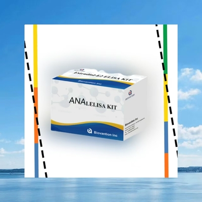 Anti ANA IgG ELISA Test Kit  Anti Nuclear IgG Antibody Qualitative Detection