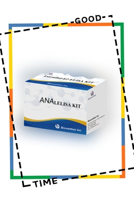Anti ANA IgG ELISA Test Kit  Anti Nuclear IgG Antibody Qualitative Detection