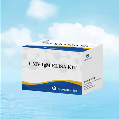 Macrophage IgM qualitative ELISA Test IVD Experimental Kit High Sensitive