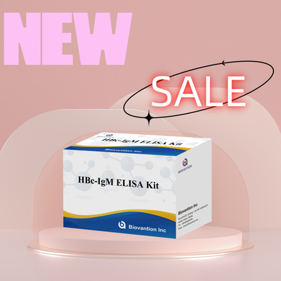 High Accuracy HBc IgM Anthgen Diagnostic Reagent Test With Enzyme-Linked Immunosorbent Assay Test Kit