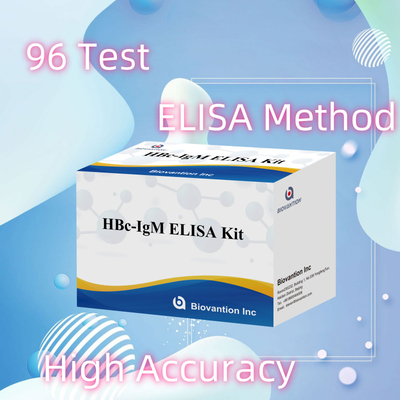 High Accuracy HBc IgM Anthgen Diagnostic Reagent Test With Enzyme-Linked Immunosorbent Assay Test Kit