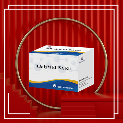 High Accuracy HBc IgM Anthgen Diagnostic Reagent Test With Enzyme-Linked Immunosorbent Assay Test Kit