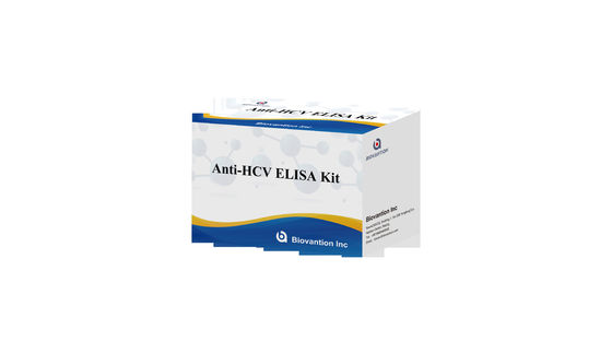 Anti-HCV Elisa Test Kit with High Specificity for 96 Tests and 1.5-3 Hours Assay Time
