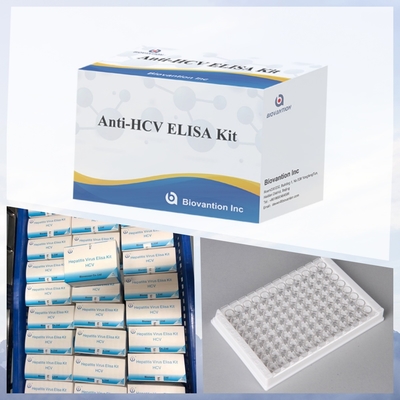 New Arrival IVD Reagent HCV Diagnostic Reagent Test For Human Hospital Clinic Lab