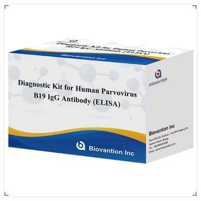 Human Use Diagnostic Kit For Human Parvovirus B19 IgM Antibody Elisa Test Kit With 96T