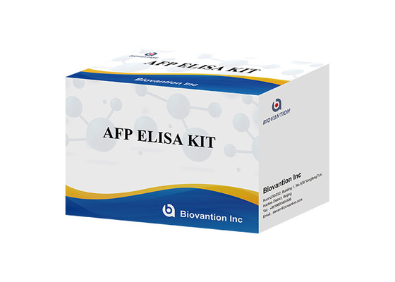 AFP Alpha Fetoprotein Elisa Test Kit Enzyme-Linked Products Transport Time Short