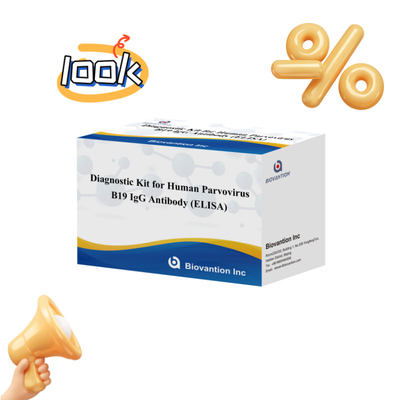 Diagnostic Kit For Human Parvovirus B19 IgM Antibody ELISA Ideal For Erythema Infectiosum And Complications In Pregnancy