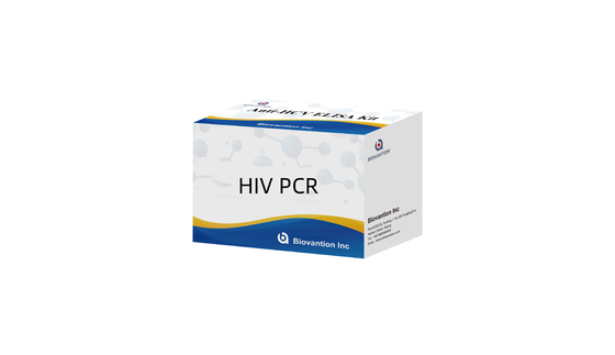HIV-1 Quantitative RT-PCR Kit In Human Serum Or Plasma By Real Time RT-PCR Method