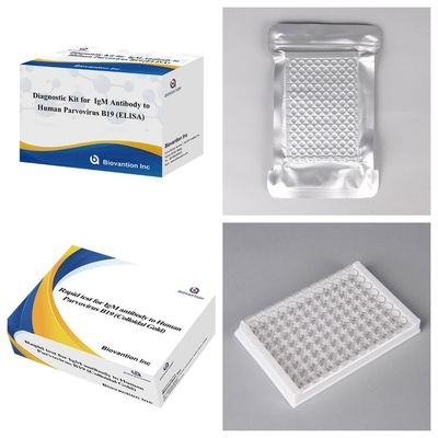 Advanced Human Parvovirus B19 IgM Antibody ELISA Test Kit For Pregnancy Detection And Screening
