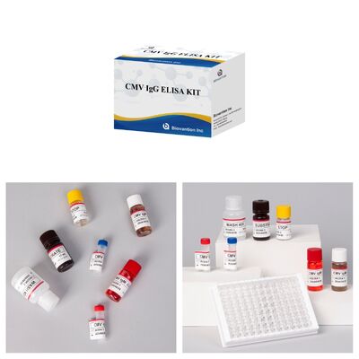 96T CMV ELISA Test Kit with Colorimetric Detection and Sandwich Method for Cytomegalovirus Antibodies