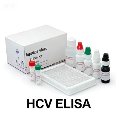Anti-HCV  Antibodies To Hepatitis C Virus Enzyme-Linked Transport Time Short