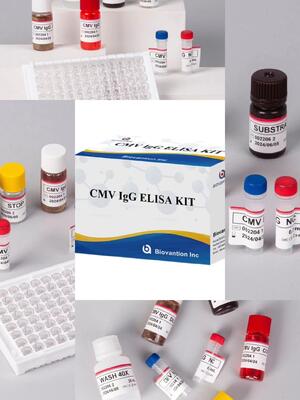 Laboratory Or Hospital High Accuracy CMV IgG Elisa Test Kit