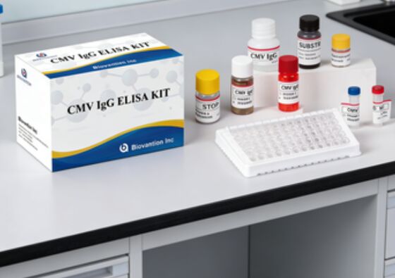 Laboratory Or Hospital High Accuracy CMV IgG Elisa Test Kit