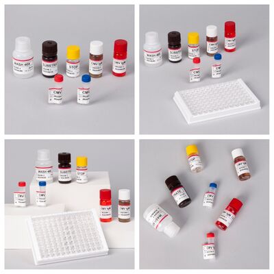Enzyme Immunoassay Reagents Elisa Test Kit For Detection Of Cytomegalovirus CMV Antibodies