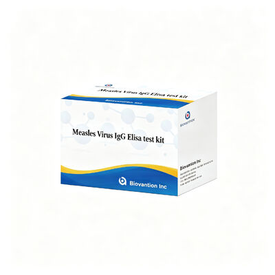 Measles Virus IgG ELISA Test Kit High Sensitivity  Specificity