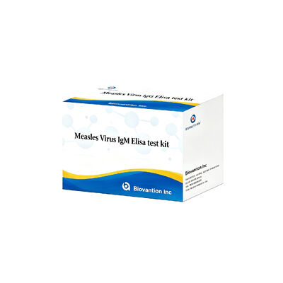 Measles Virus IgM ELISA Test Kit 96T Early Acute Infection Detection